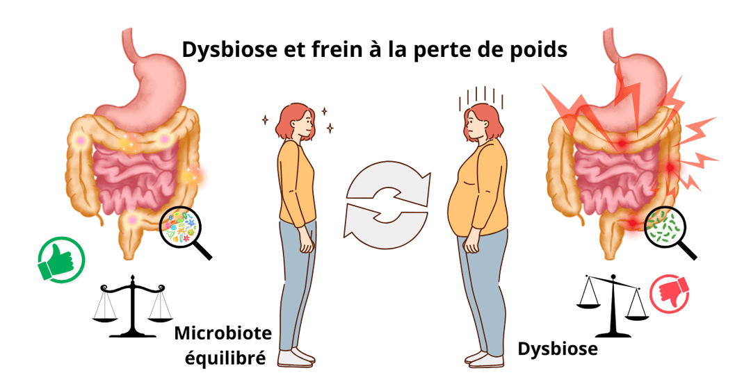 Explication de la Dysbiose digestive en schéma