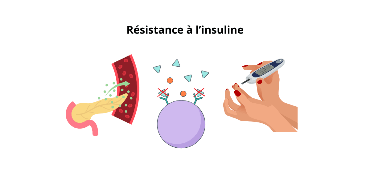 Resistance à l'insuline expliqué en schéma